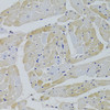 Immunohistochemistry of paraffin-embedded Rat heart using GPD1 Polyclonal Antibody at dilution of  1:100 (40x lens).