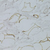 Immunohistochemistry of paraffin-embedded Human breast adipocytes using GPD1 Polyclonal Antibody at dilution of  1:100 (40x lens).