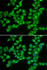 Immunofluorescence analysis of A549 cells using HADHB Polyclonal Antibody