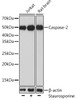 Western blot analysis of extracts of various cell lines using Caspase-2 Polyclonal Antibody at dilution of 1:1000. Jurkat cells were treated by Staurosporine(1uM) at room tempeRature for 3 hours.
