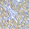 Immunohistochemistry of paraffin-embedded Rat kidney using CRYAA Polyclonal Antibody at dilution of  1:200 (40x lens).