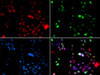 Immunofluorescence analysis of GFP-RNF168 transgenic U2OS cells using PIAS1 Polyclonal Antibody