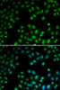 Immunofluorescence analysis of U2OS cells using PIAS1 Polyclonal Antibody