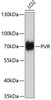 Western blot analysis of extracts of LO2 cells using CD155/PVR Polyclonal Antibody at dilution of 1:1000.