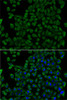 Immunofluorescence analysis of U2OS cells using TCN2 Polyclonal Antibody