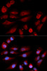 Immunofluorescence analysis of U2OS cells using 53BP1 Polyclonal Antibody