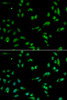 Immunofluorescence analysis of A549 cells using ANP32A Polyclonal Antibody