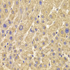 Immunohistochemistry of paraffin-embedded Human liver damage using PEX5 Polyclonal Antibody at dilution of  1:100 (40x lens).