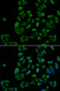 Immunofluorescence analysis of HeLa cells using PEX5 Polyclonal Antibody