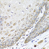 Immunohistochemistry of paraffin-embedded Human esophagus using DEDD Polyclonal Antibody at dilution of  1:100 (40x lens).