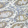 Immunohistochemistry of paraffin-embedded Human colon using DDX20 Polyclonal Antibody at dilution of  1:100 (40x lens).