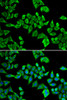 Immunofluorescence analysis of HeLa cells using DDX20 Polyclonal Antibody