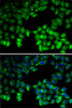 Immunofluorescence analysis of U2OS cells using NEIL1 Polyclonal Antibody