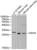Western blot analysis of extracts of various cell lines using PDYN Polyclonal Antibody at dilution of 1:1000.