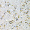 Immunohistochemistry of paraffin-embedded Mouse brain using PDYN Polyclonal Antibody at dilution of  1:100 (40x lens).