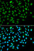 Immunofluorescence analysis of A549 cells using ING3 Polyclonal Antibody