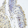 Immunohistochemistry of paraffin-embedded Mouse lung using RHOT1 Polyclonal Antibody at dilution of  1:100 (40x lens).