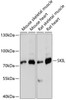 Western blot analysis of extracts of various cell lines using SKIL Polyclonal Antibody at dilution of 1:3000.