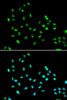 Immunofluorescence analysis of A549 cells using SMARCAD1 Polyclonal Antibody
