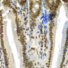 Immunohistochemistry of paraffin-embedded Mouse Intestine using SF3B2 Polyclonal Antibody at dilution of  1:100 (40x lens).