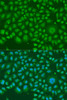 Immunofluorescence analysis of U2OS cells using HNRNPR Polyclonal Antibody at dilution of  1:100. Blue: DAPI for nuclear staining.
