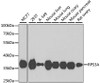 Western blot analysis of extracts of various cell lines using RPS3A Polyclonal Antibody at dilution of 1:1000.