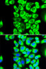 Immunofluorescence analysis of MCF-7 cells using RPS3A Polyclonal Antibody