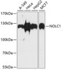 Western blot analysis of extracts of various cell lines using NOLC1 Polyclonal Antibody at dilution of 1:1000.