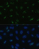 Immunofluorescence analysis of U-2 OS cells using NOLC1 Polyclonal Antibody at dilution of  1:100. Blue: DAPI for nuclear staining.