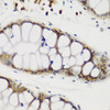 Immunohistochemistry of paraffin-embedded Human gastric using NCL Polyclonal Antibody at dilution of  1:200 (40x lens).