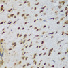 Immunohistochemistry of paraffin-embedded Mouse brain using NCL Polyclonal Antibody at dilution of  1:200 (40x lens).