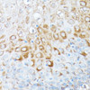 Immunohistochemistry of paraffin-embedded Human esophageal using RPL7 Polyclonal Antibody at dilution of  1:100 (40x lens).