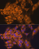 Immunofluorescence analysis of C6 cells using RPL17 Polyclonal Antibody at dilution of  1:100. Blue: DAPI for nuclear staining.