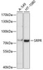 Western blot analysis of extracts of various cell lines using SRPR Polyclonal Antibody at dilution of 1:1000.