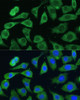 Immunofluorescence analysis of L-929 cells using EIF3D Polyclonal Antibody at dilution of  1:100. Blue: DAPI for nuclear staining.