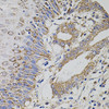 Immunohistochemistry of paraffin-embedded Human esophagus using TRMT2A Polyclonal Antibody at dilution of  1:100 (40x lens).