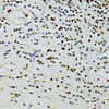 Immunohistochemistry of paraffin-embedded Human vermiform appendix using ALYREF Polyclonal Antibody at dilution of  1:100 (40x lens).