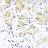 Immunohistochemistry of paraffin-embedded Human stomach using Argonaute-2 Polyclonal Antibody at dilution of  1:100 (40x lens).