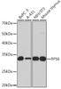 Western blot analysis of extracts of various cell lines using RPS6 Polyclonal Antibody at dilution of 1:1000.