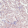 Immunohistochemistry of paraffin-embedded Human appendix using SNRNP70 Polyclonal Antibody at dilution of  1:100 (40x lens).