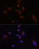 Immunofluorescence analysis of C6 cells using ELAVL3 Polyclonal Antibody at dilution of  1:100 (40x lens). Blue: DAPI for nuclear staining.