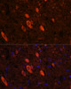 Immunofluorescence analysis of Rat brain using ELAVL3 Polyclonal Antibody at dilution of  1:100 (40x lens). Blue: DAPI for nuclear staining.