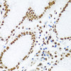 Immunohistochemistry of paraffin-embedded Human stomach using KHDRBS1 Polyclonal Antibody at dilution of  1:100 (40x lens).