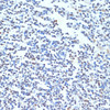 Immunohistochemistry of paraffin-embedded Human tonsil using PTBP1 Polyclonal Antibody at dilution of  1:100 (40x lens).