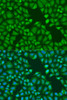 Immunofluorescence analysis of U2OS cells using TNRC6A Polyclonal Antibody at dilution of  1:100. Blue: DAPI for nuclear staining.