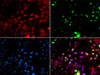 Immunofluorescence analysis of GFP-RNF168 transgenic U2OS cells using POLK Polyclonal Antibody