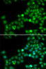 Immunofluorescence analysis of U2OS cells using POLK Polyclonal Antibody