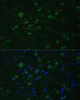 Immunofluorescence analysis of Mouse brain using KMT2E Polyclonal Antibody at dilution of  1:100. Blue: DAPI for nuclear staining.