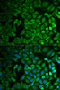 Immunofluorescence analysis of MCF-7 cells using FBXO11 Polyclonal Antibody