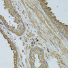 Immunohistochemistry of paraffin-embedded Human prostate using MYLIP Polyclonal Antibody at dilution of  1:100 (40x lens).